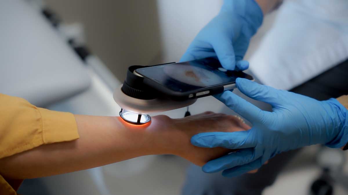 FORTEMED dermatoskopie